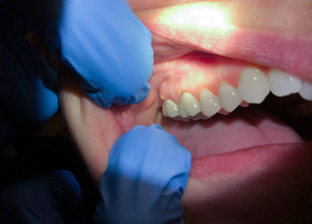 Best Emergency Root Canal Treatment in Corunna, MI