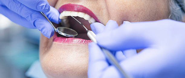 Best Broken or Cracked Tooth Emergency Dentist in Corunna, MI